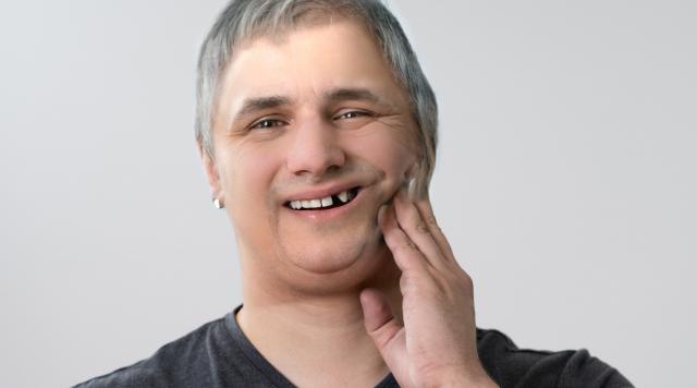 Vrste Implantoloških zahvata kod nedostatka jednog zuba